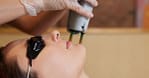 Carbon Laser Treatment