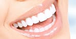 Scaling And Polishing With X-Ray At Omar Yahia Dental Surgery Clinic Dubai